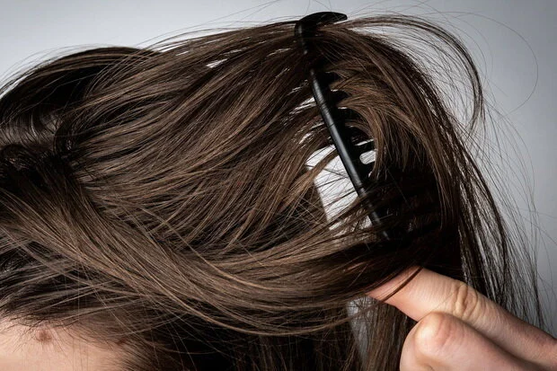 Beberapa Tips Ampuh Mengatasi Rambut Berminyak dan Lepek